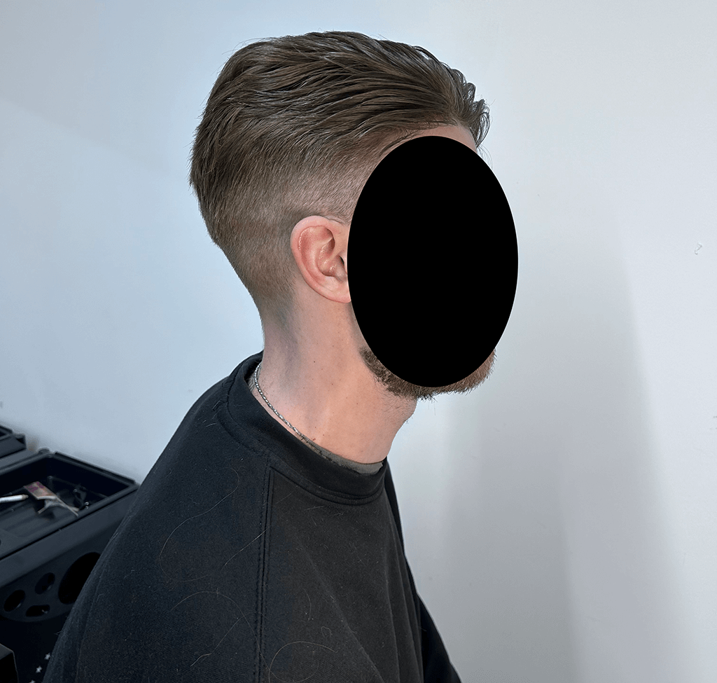 Mens_Hair_Replacement